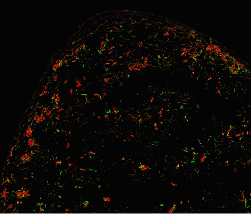 Clofazimine - Gus Rosania, Department of Pharmaceutical Sciences, University of Michigan College of Pharmacy