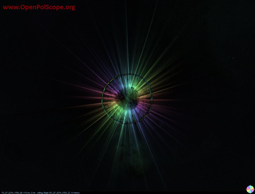 Heliozoa imaged in Birefringence mode
